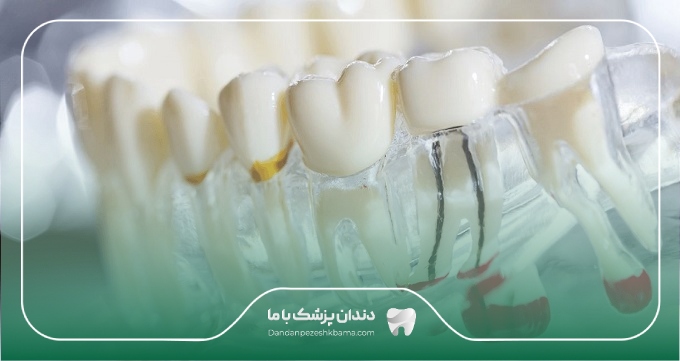 تعرفه خدمات بهترین دکتر عصب‌کشی در نیاوران