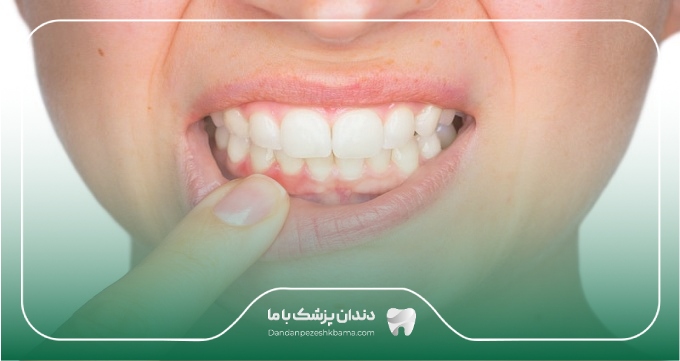 هزینه خدمات بهترین جراح لثه در اهواز