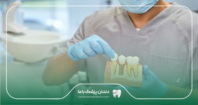 مراحل انجام ایمپلنت