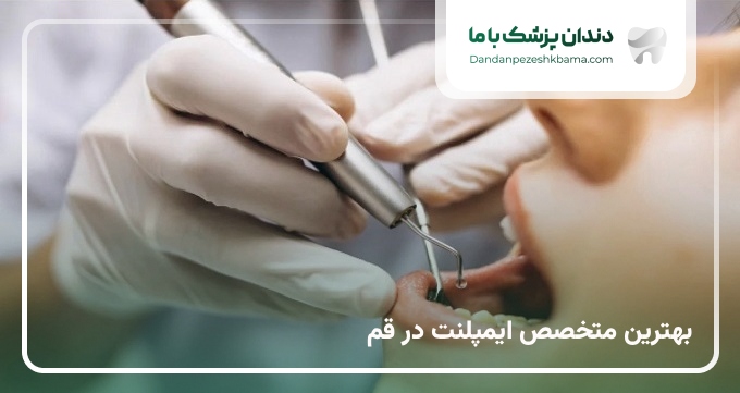 بهترین متخصص ایمپلنت در قم