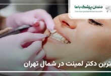 بهترین دکتر لمینت در شمال تهران