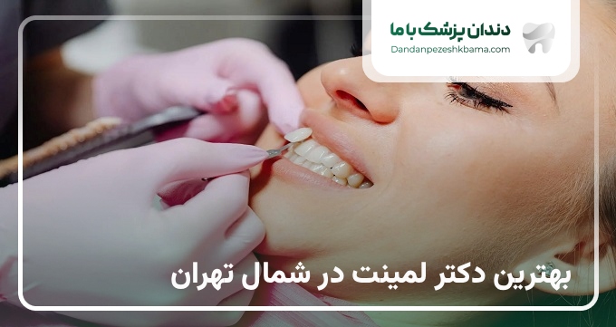 بهترین دکتر لمینت در شمال تهران