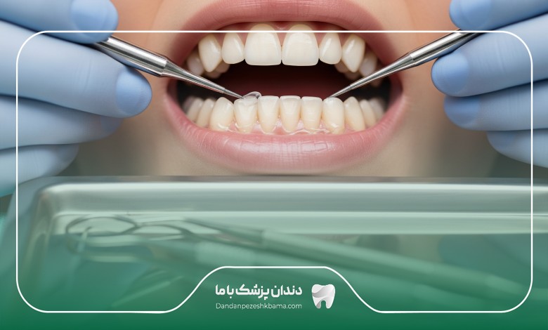 هزینه خدمات بهترین دکتر کامپوزیت در قم