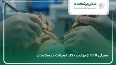 بهترین دکتر ایمپلنت در ستارخان