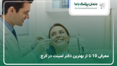 بهترین دکتنر لمینت در کرج