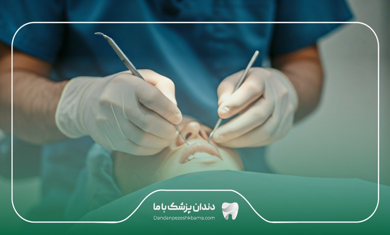 مراحل لمینت توسط بهترین دندانپزشکان ساری