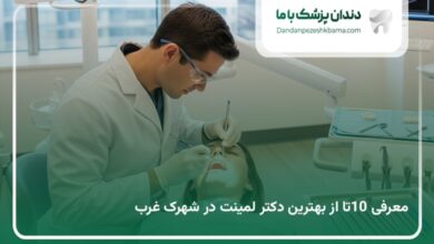 بهترین دکتر لمینت دندان در شهرک غرب