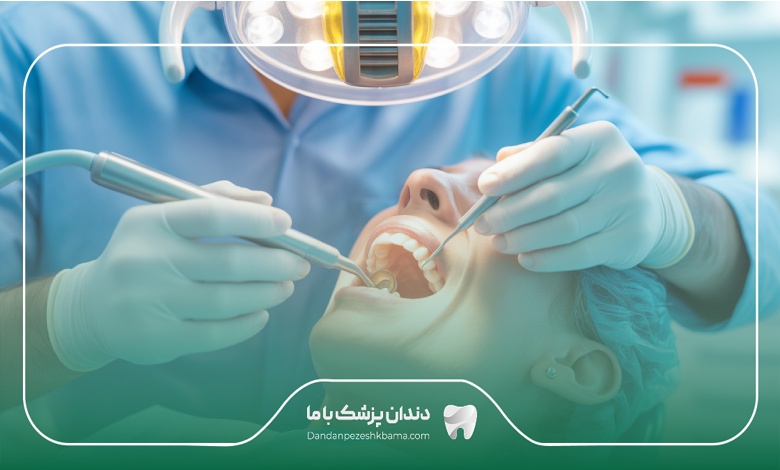مراحل درمان ریشه دندان توسط بهترین دندانپزشکان درمان ریشه