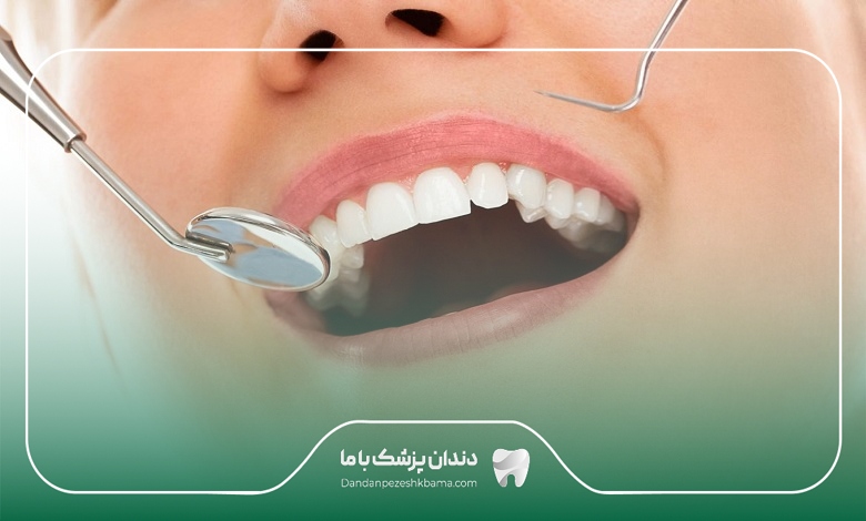 عوامل موثر بر تعرفه خدمات بهترین دکتر کامپوزیت در نیاوران