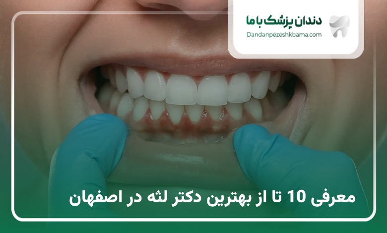 بهترین دکتر لثه در اصفهان