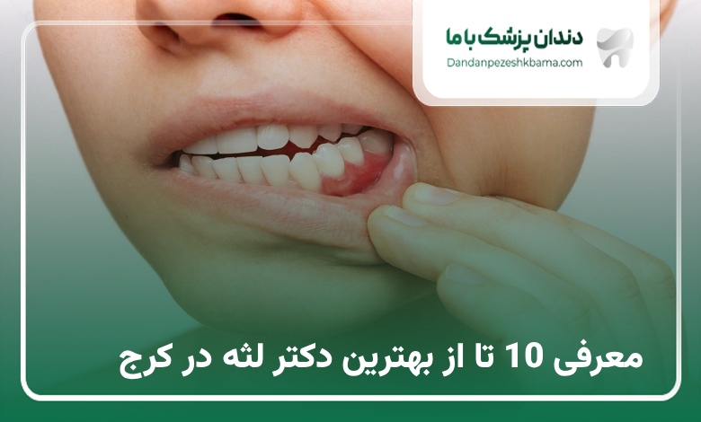 بهترین دکتر لثه در کرج