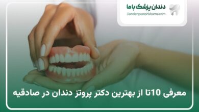 بهترین دکتر پروتز دندان در صادقیه