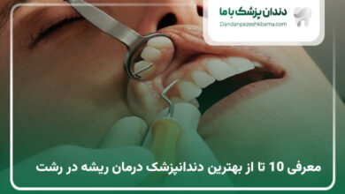 بهترین دندانپزشک درمان ریشه در رشت