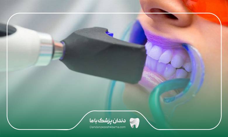 بهترین دکتر بلیچینگ در ایران