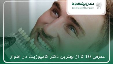 بهترین دکتر کامپوزیت در اهواز