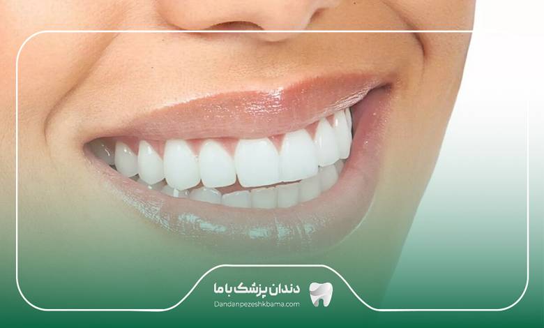 بهترین دکتر کامپوزیت در اهواز
