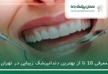 بهترین دندانپزشک زیبایی در تهران