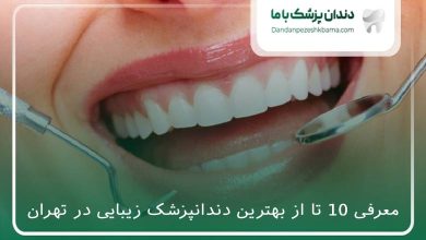 بهترین دندانپزشک زیبایی در تهران