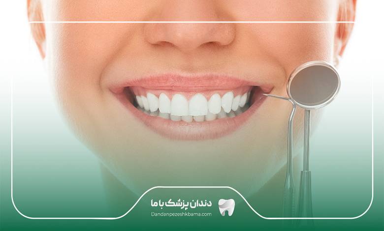 بهترین دندانپزشک زیبایی در تهران