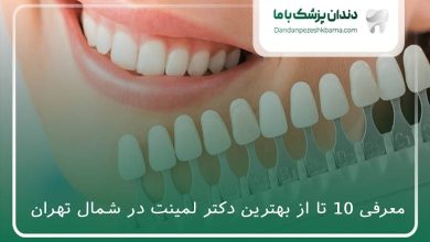 بهترین دکتر لمینت در شمال تهران
