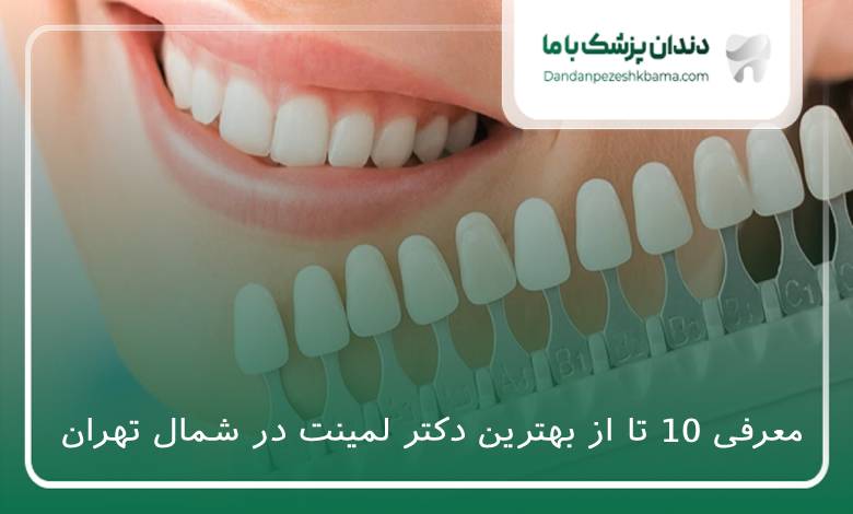 بهترین دکتر لمینت در شمال تهران