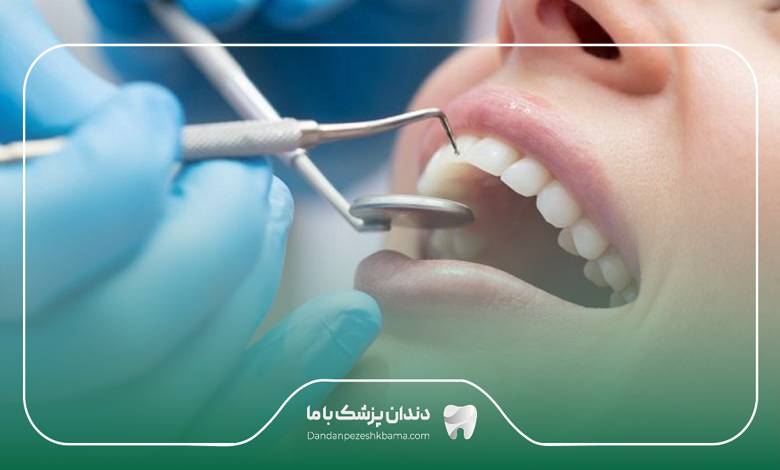 بهترین دکتر لمینت در شمال تهران